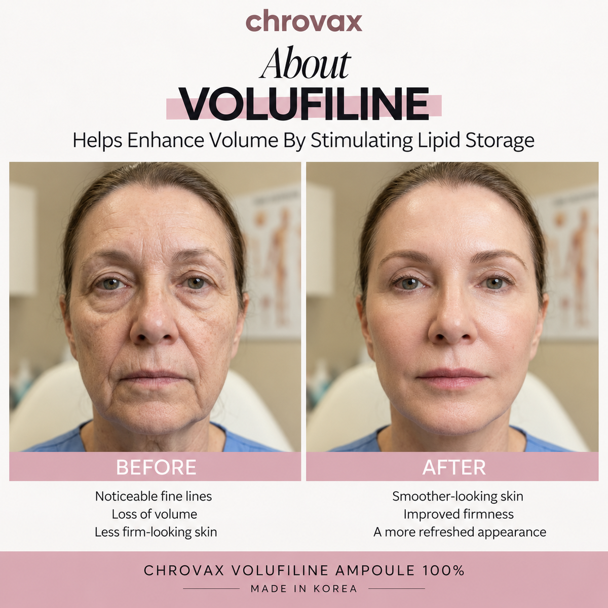 Volufiline 100% Plumping Ampoule